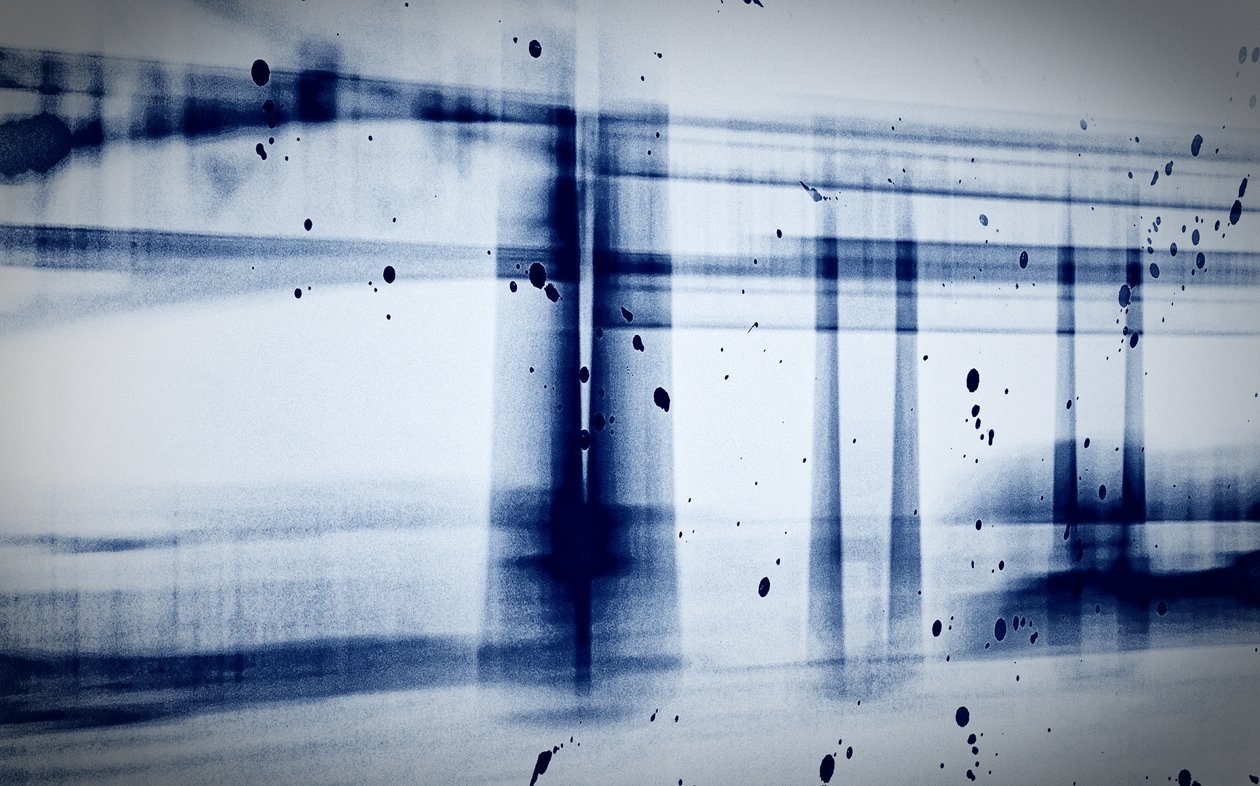 Snow (X-ray), 2019 by Alex Caminker