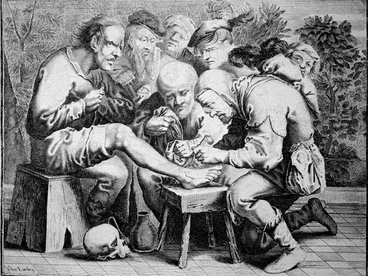 Ankle surgery (engraving) by Anonymous Anonymous