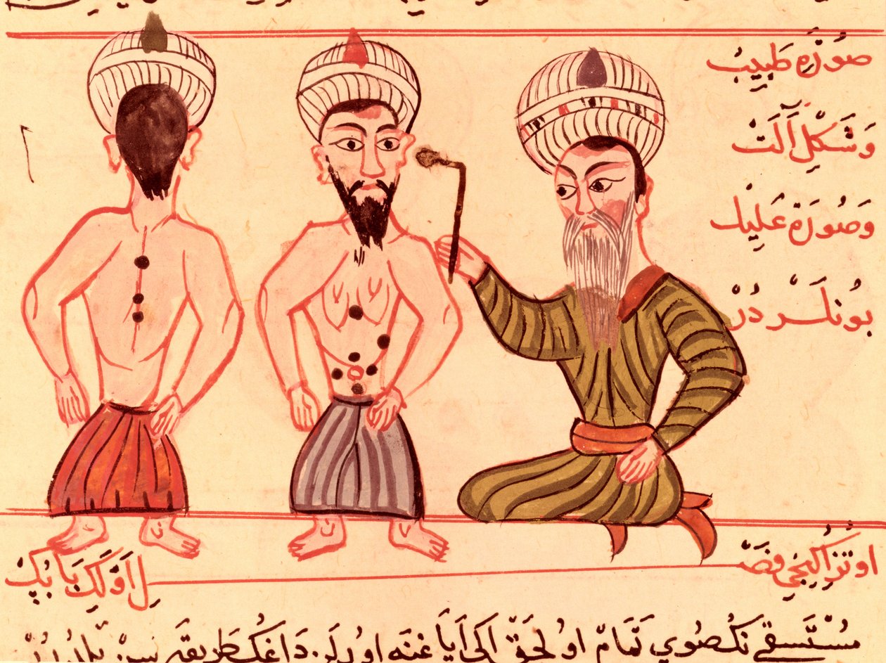 Ms Sup Turc 693 fol.35 Operation for Cauterisation, 1466 by Charaf ed Din