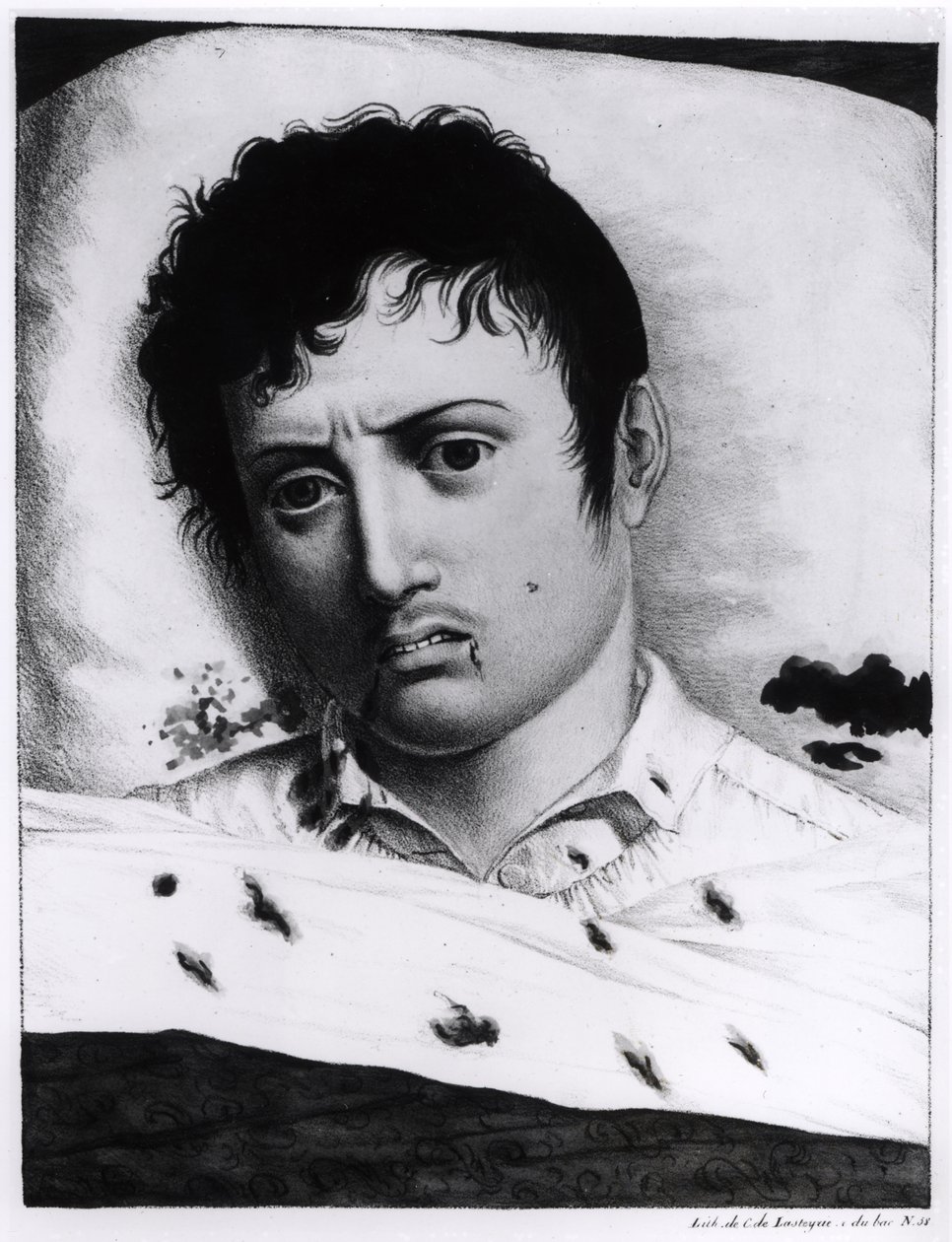 Observation of Yellow Fever, c.1819 by Charles Lasteyrie du Saillant