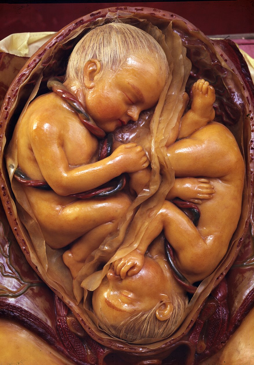 Model of twins in the womb by Clemente Susini