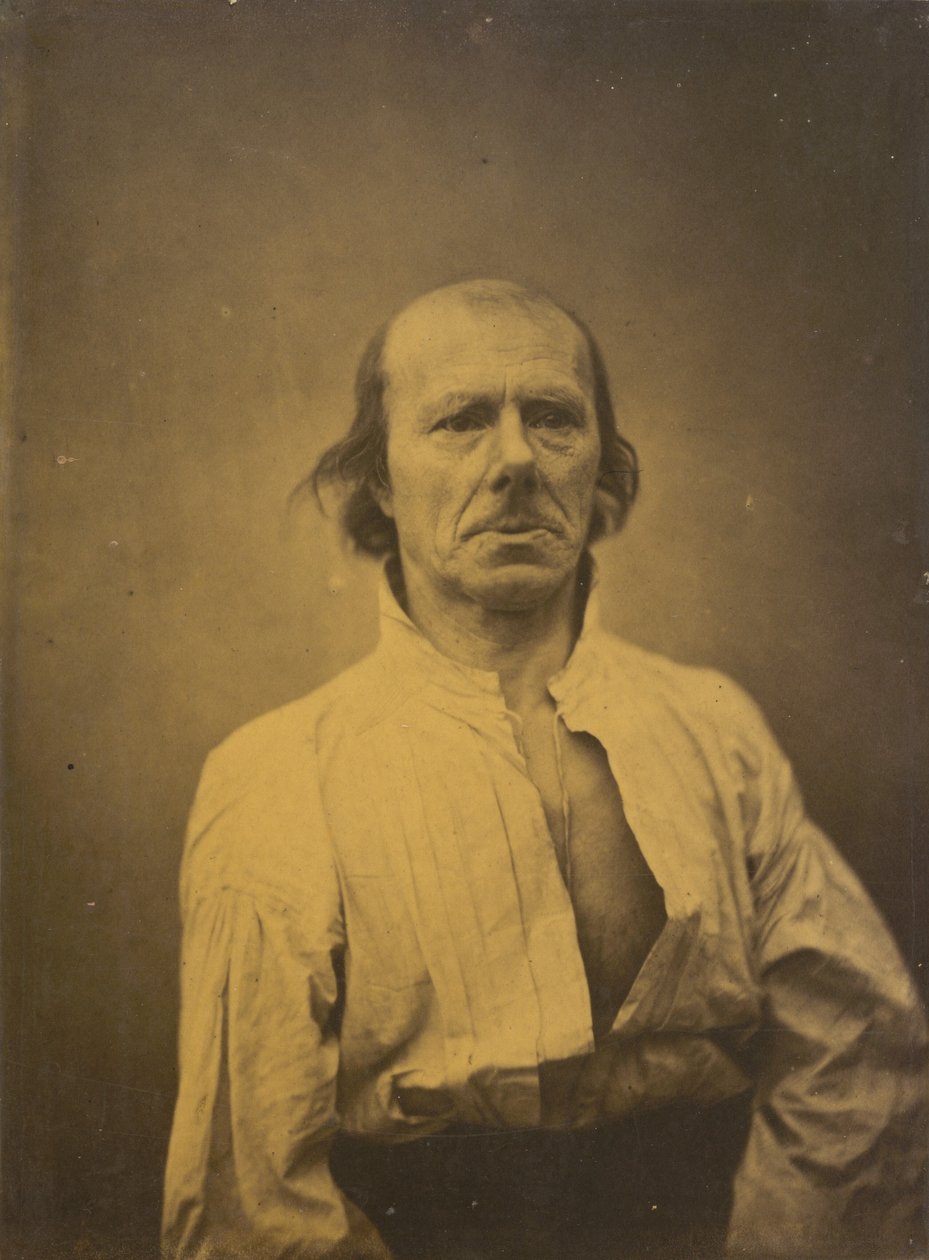 Face in repose by Duchenne de Boulogne