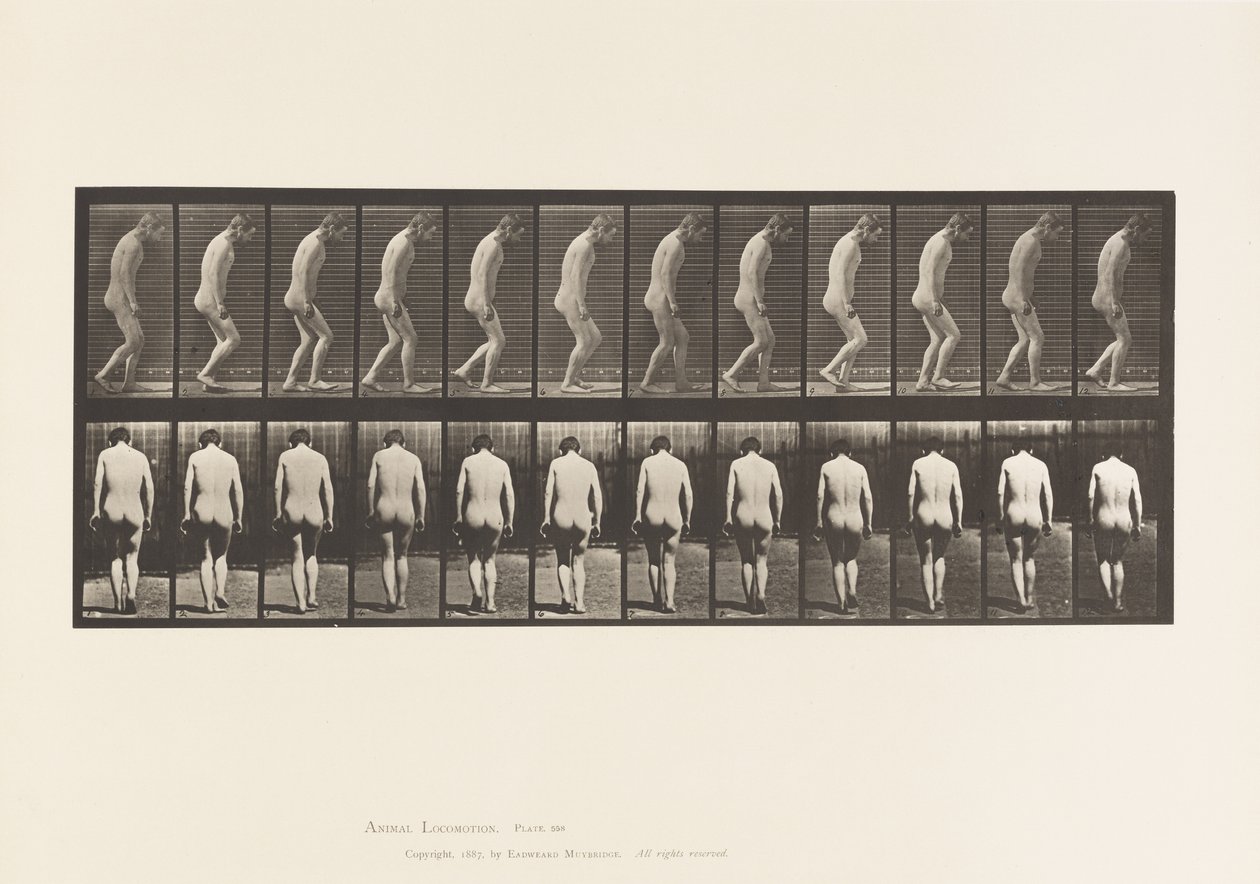 Paraplegia; Partial; Walking by Eadweard Muybridge