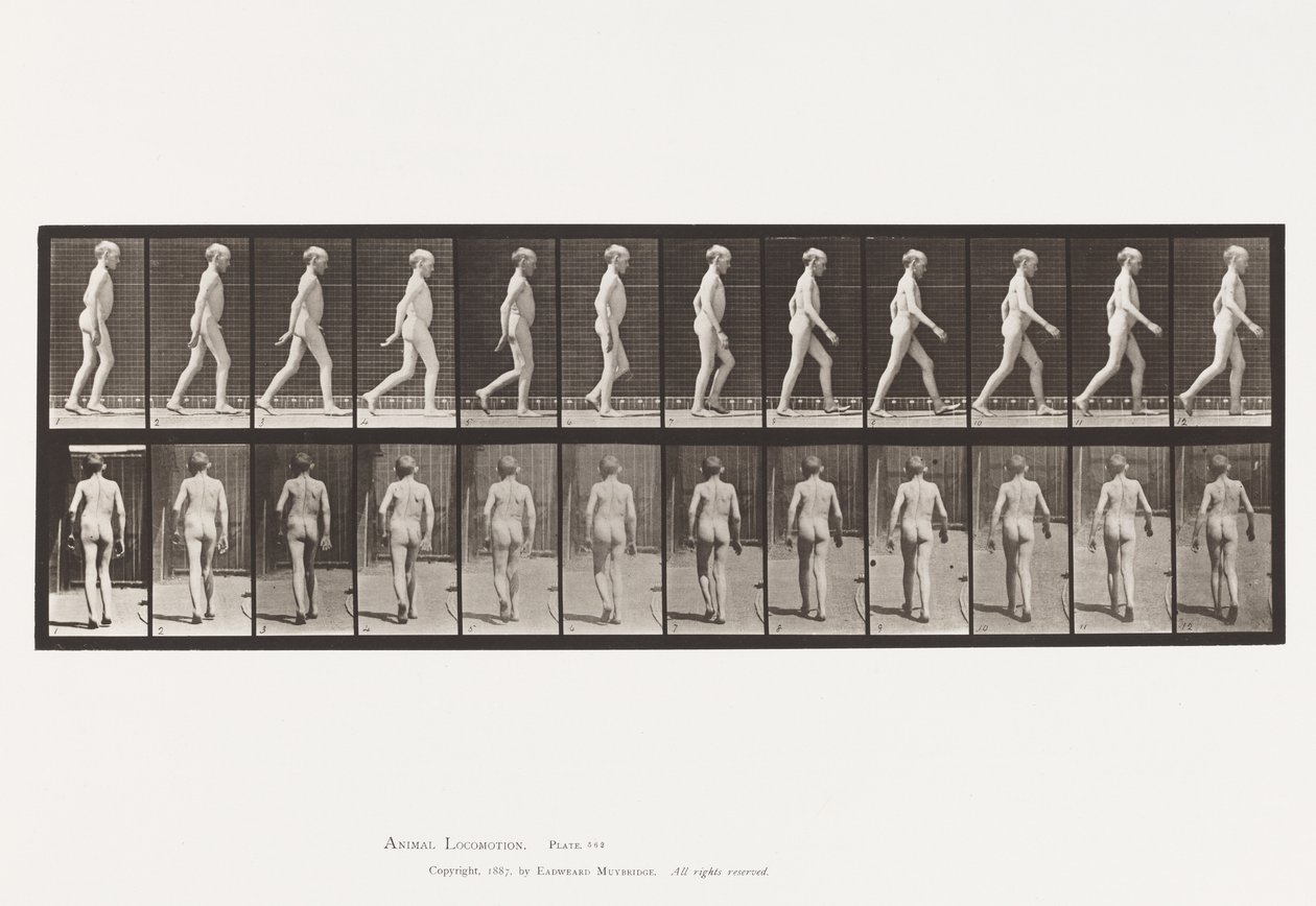 Lateral Curvature of Spine; Walking (Plate 562) by Eadweard Muybridge