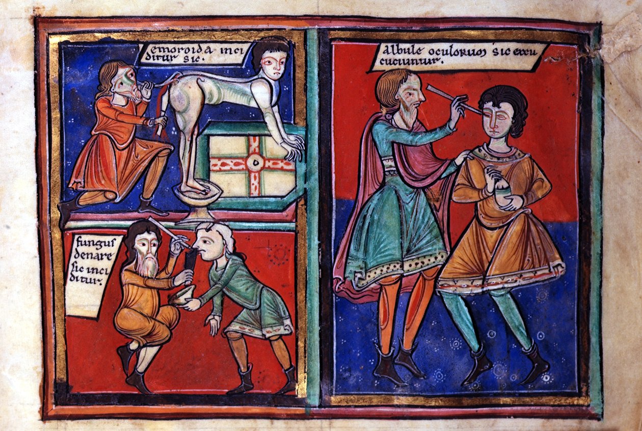 Sloane Ms 1975 fol.93 Medical operations by English School