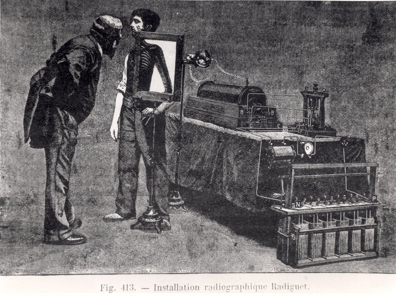 Radiguet x-ray machine by French School