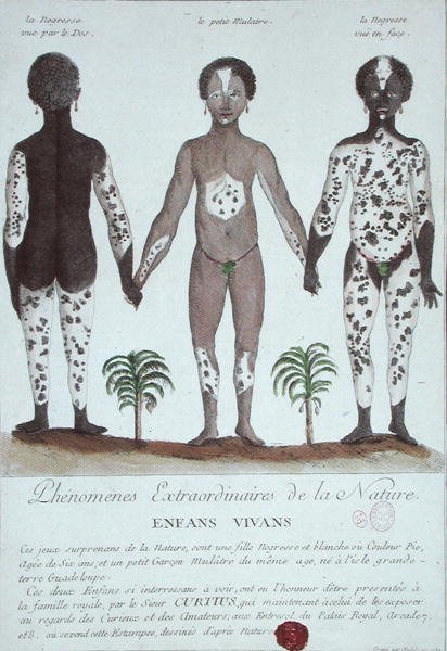 The Phenomenon of Leukoderma by French School