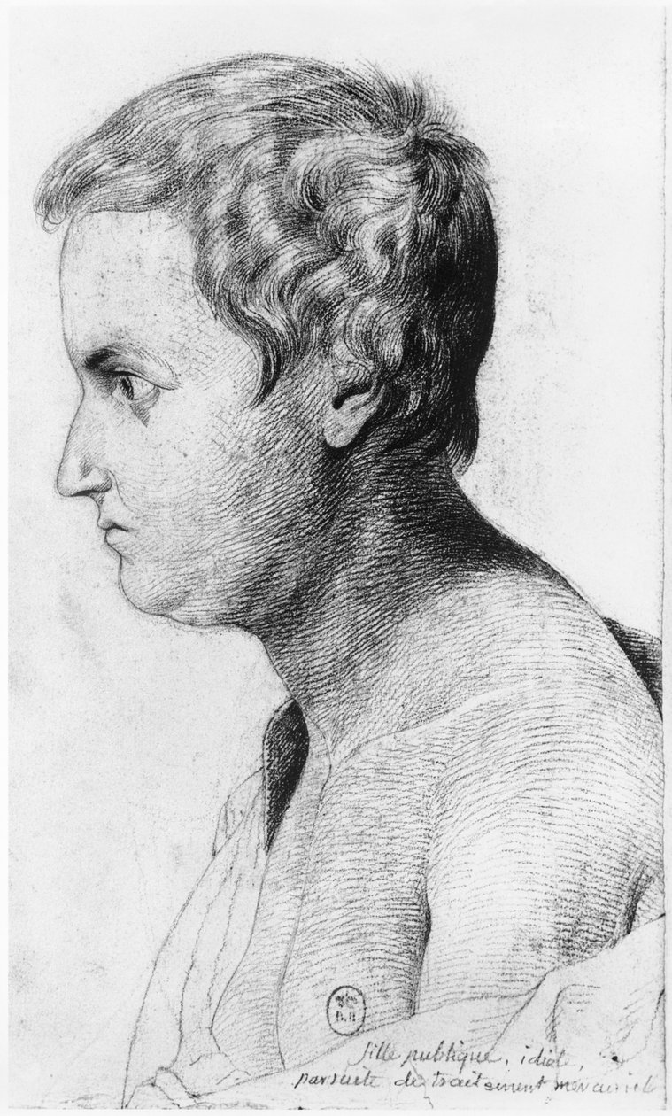 Idiotic prostitute suffering from syphilis, illustration from an unpublished treatise by Jean Etienne Dominique Esquirol on the lunatics of the Salpetriere asylum by Georges Francois Gabriel
