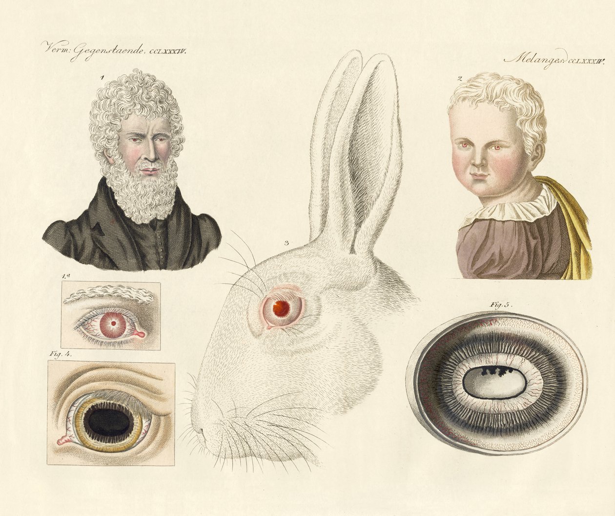 Albinos by German School