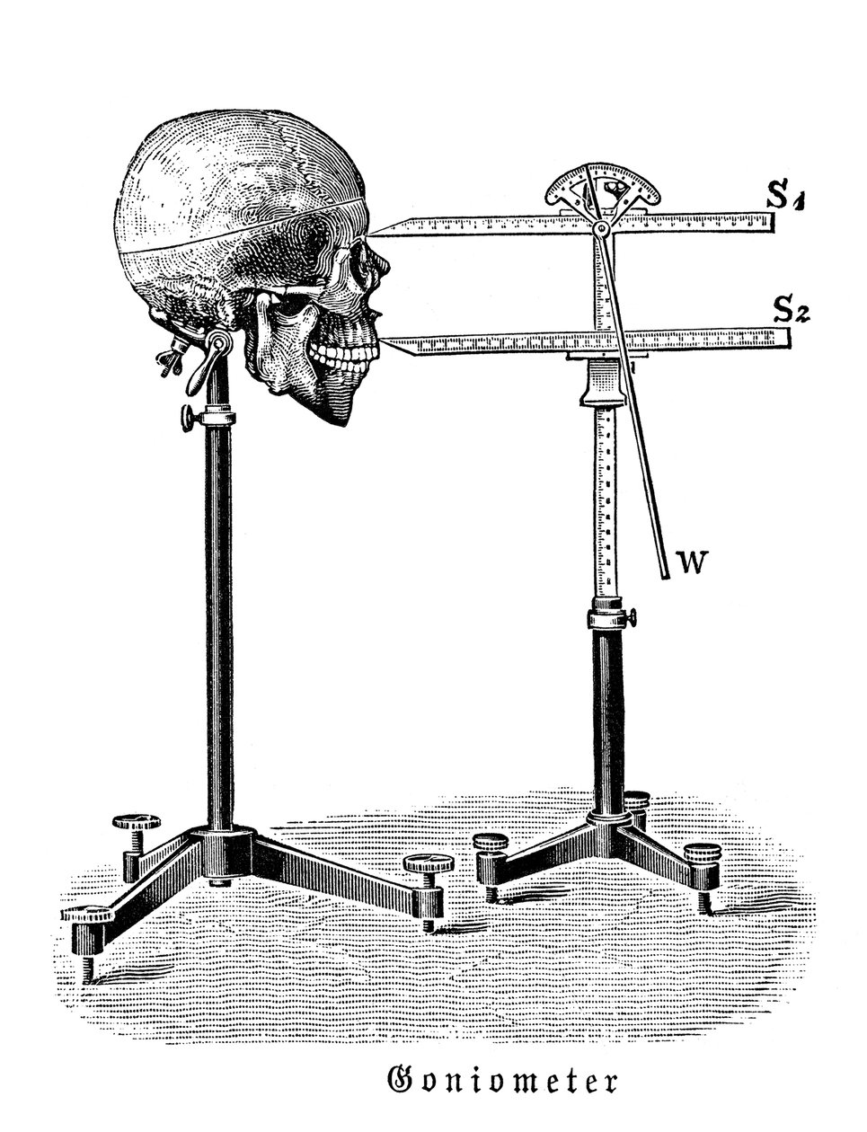 Goniometer Measuring Human Skull by German School