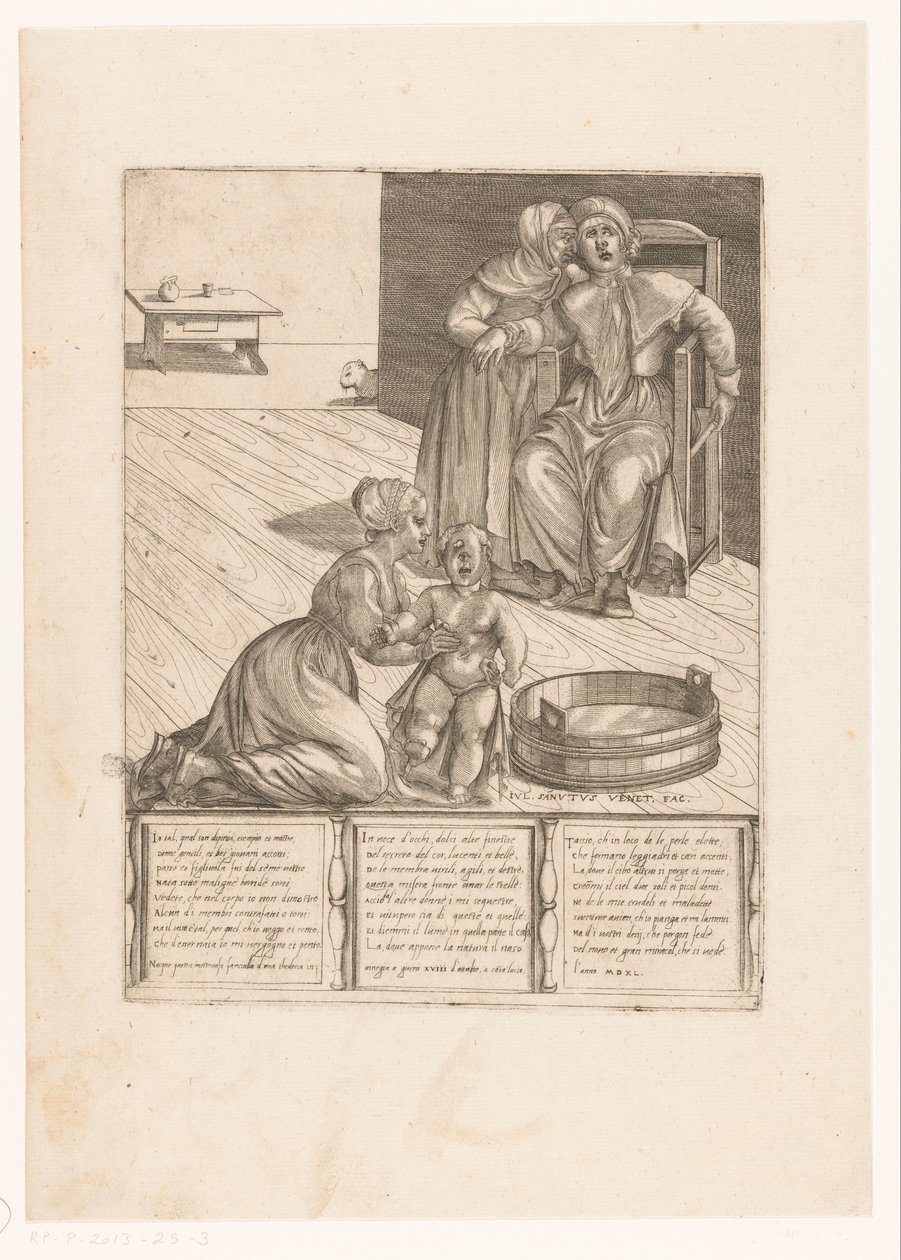 Birth of a Deformed Child by Giulio Sanuto
