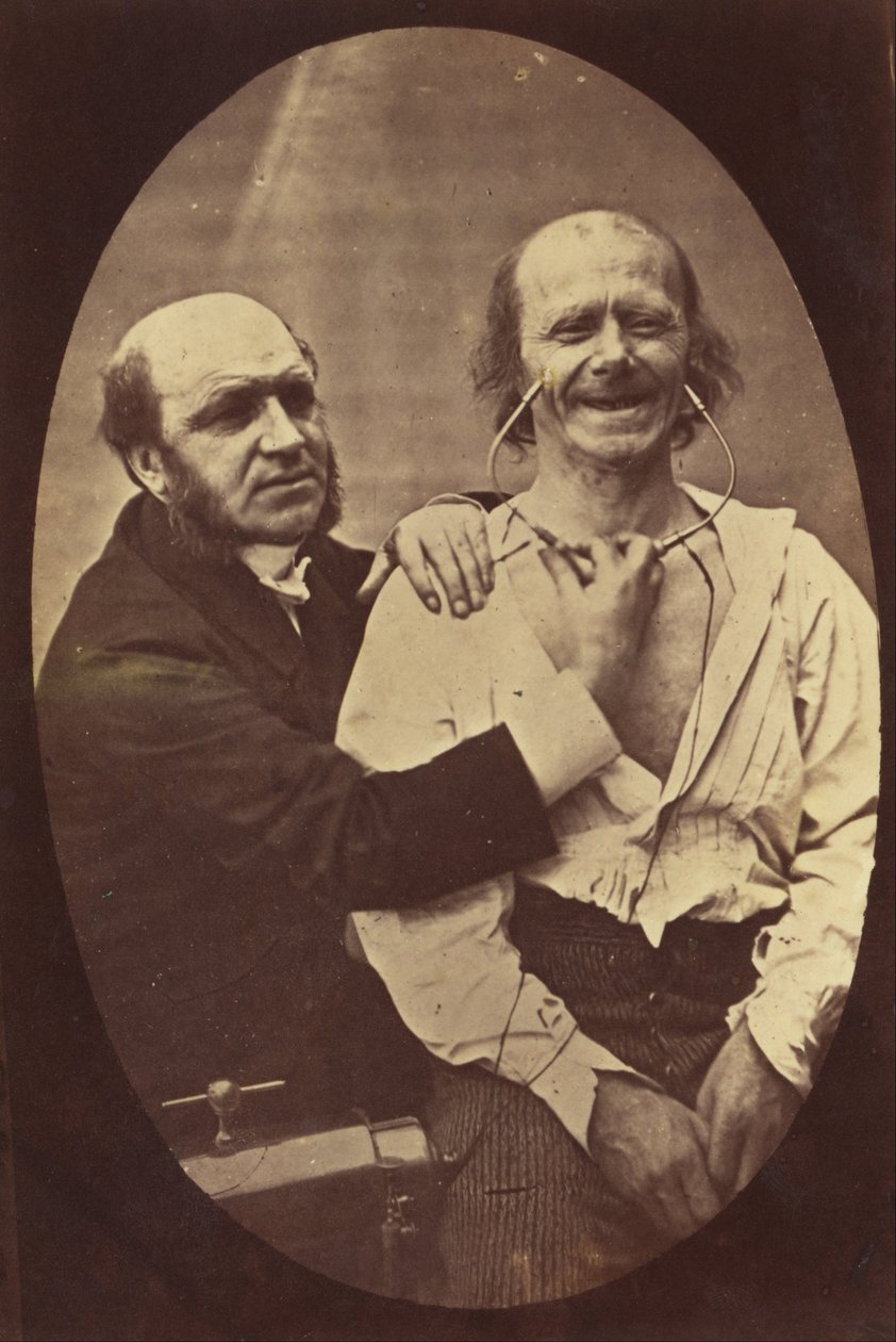 Mechanism of Human Physiognomy or Electro-Physiological Analysis of the Expression of Passions by Guillaume Benjamin Armand Duchenne de Boulogne