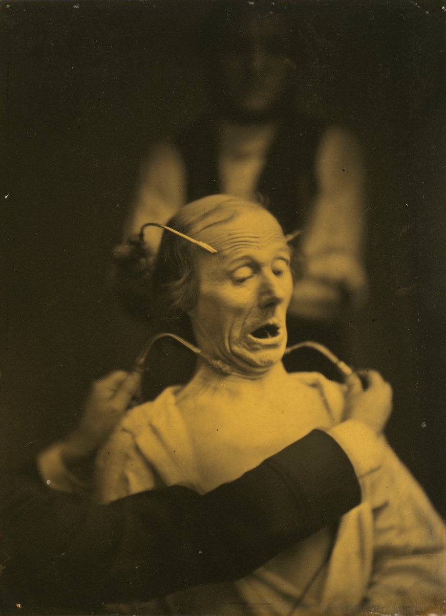 Expression of Terror by Guillaume Benjamin Amant Duchenne