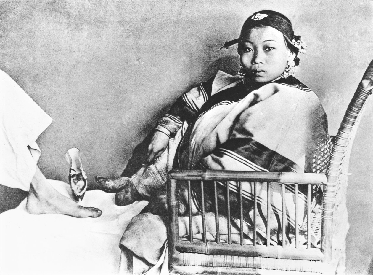 Chinese Woman Showing Her Uncovered Bound Foot Near an European Foot by John Thomson