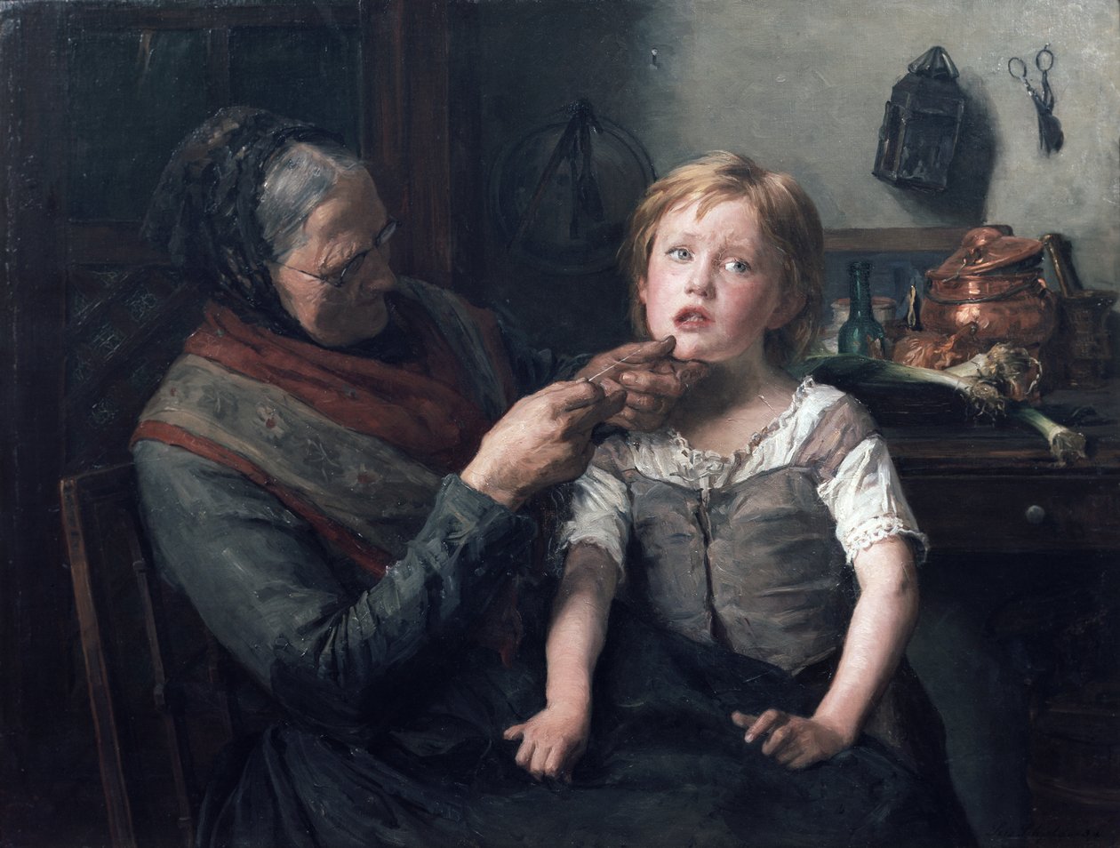 An operation by Leis Schjelderup