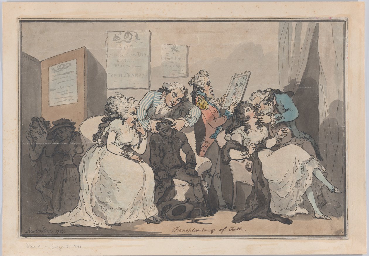 Transplanting of Teeth, 1787 by Thomas Rowlandson
