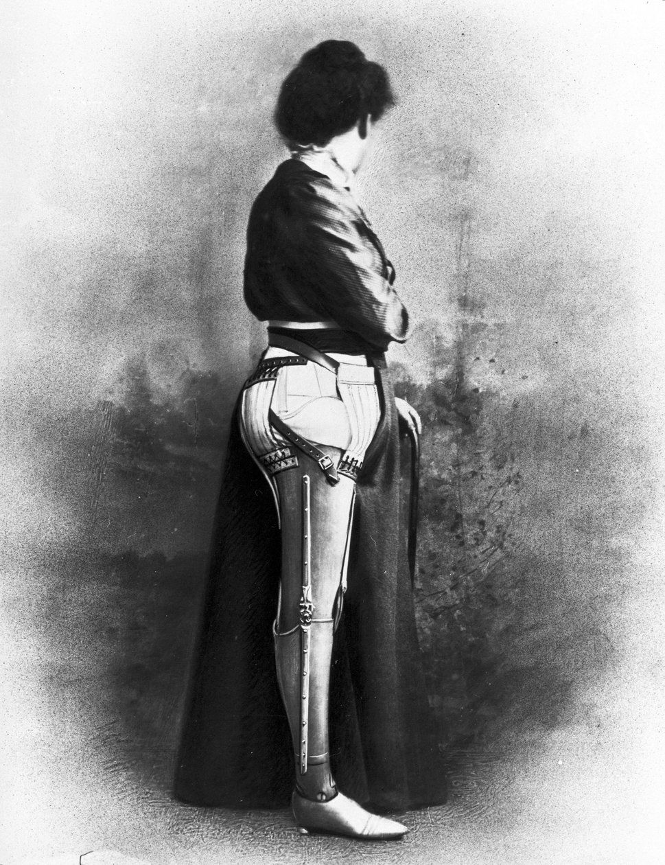 Woman wearing an artificial leg by Unbekannt