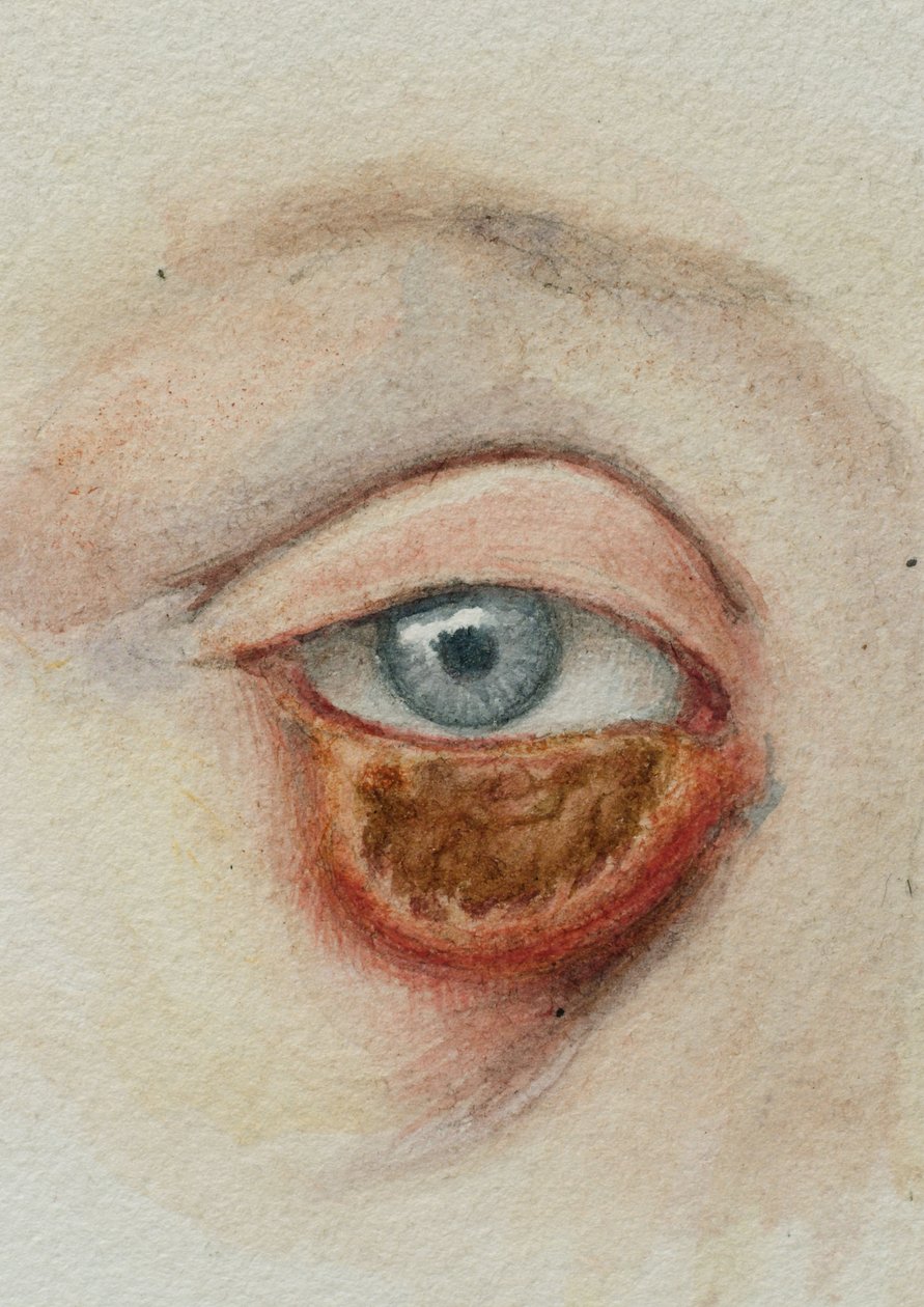 Eyes by Frederick (attr. to) Barnard