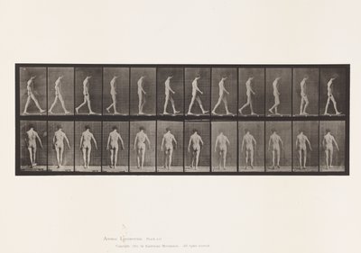 Locomotor Ataxia; Walking by Eadweard Muybridge