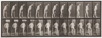 Hemiplegia; Walking with Crutch by Eadweard Muybridge