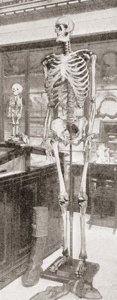 The Skeletons of Charles Byrne by English School