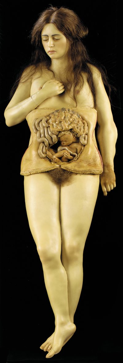 Anatomical model of an ovarian pregnancy by European School