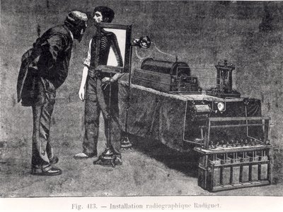 Radiguet x-ray machine by French School
