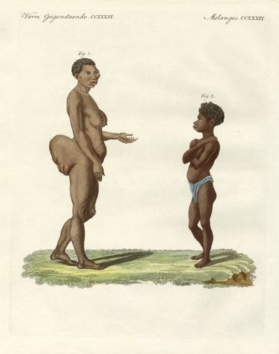 Strange human varieties by German School