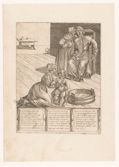 Birth of a Deformed Child by Giulio Sanuto