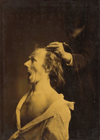 Astonishment, Stupefaction, Amazement by Guillaume Benjamin Amant Duchenne
