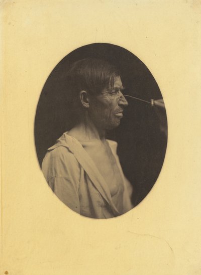 Bad Humor, Malcontentment by Guillaume Benjamin Amant Duchenne