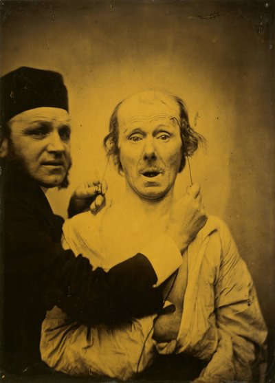 Surprise by Guillaume Benjamin Amant Duchenne