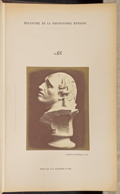 Figure 66 by Guillaume Benjamin Duchenne