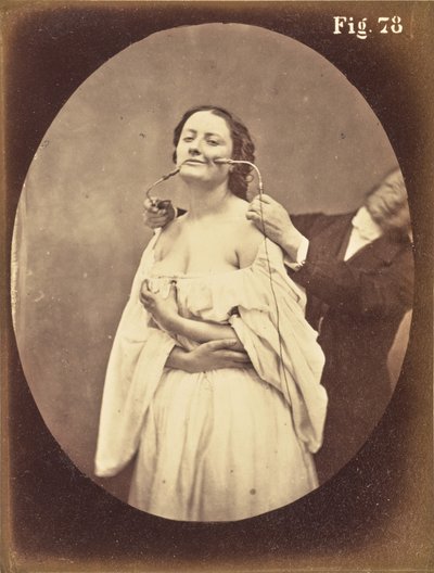 Figure 78 by Guillaume Benjamin Duchenne