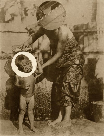 Birthmark (Salome) by Laszlo Moholy Nagy