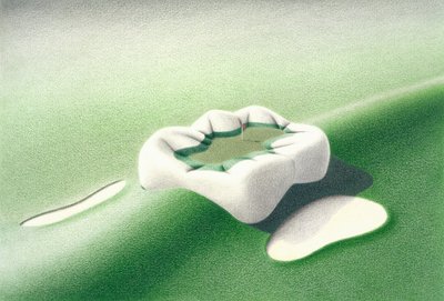 Inlay by Rene Boin