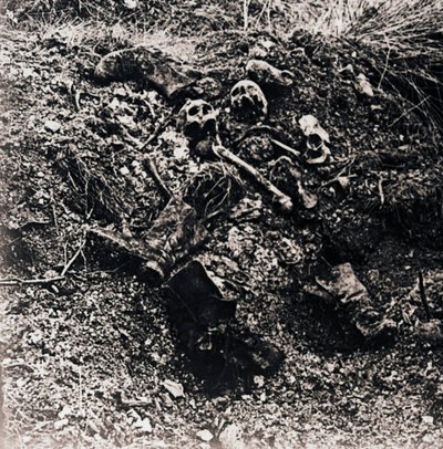 Human Remains by Unbekannt