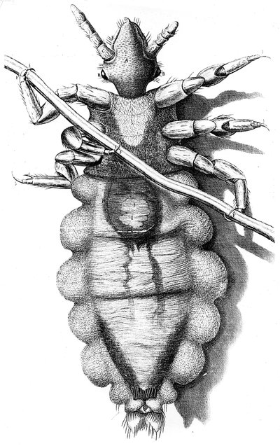 Louse Clinging to a Human Hair by Unbekannt