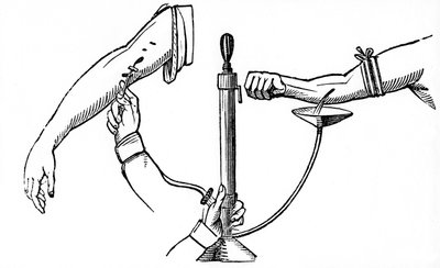 Person-to-Person Blood Transfusion by Unbekannt