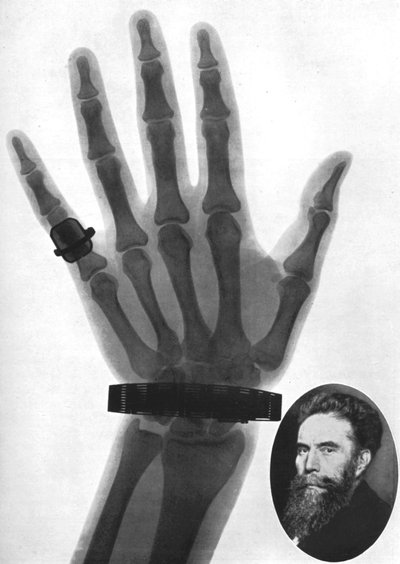 X-ray photograph of a hand, 1926 by Unbekannt