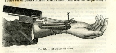 Direct sphygmograph by Unbekannter Künstler