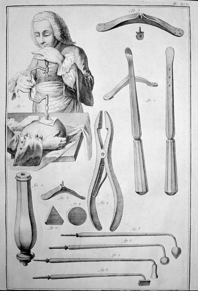 Trepanation of the Skull, Various Instruments by Unknown artist