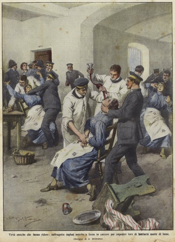 British suffragettes being force-fed in prisons by Achille Beltrame