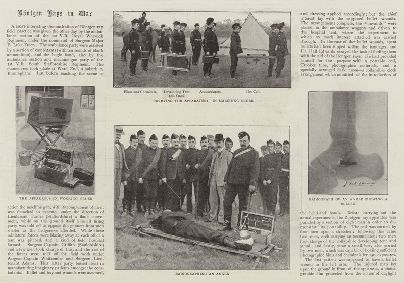 Rontgen Rays in War by English Photographer
