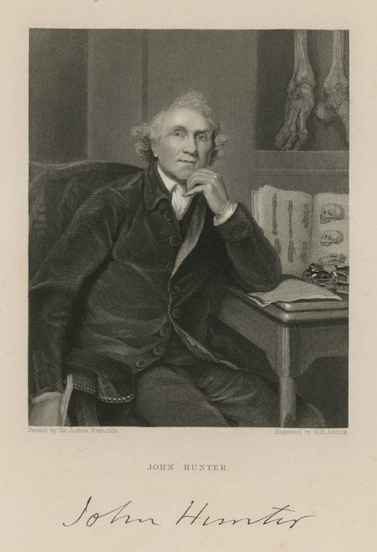 John Hunter by English School