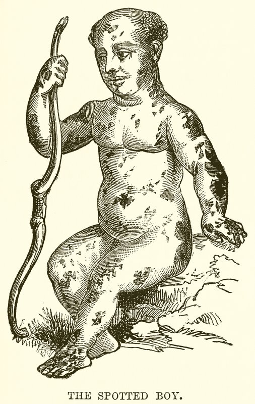 The Spotted Boy by English School