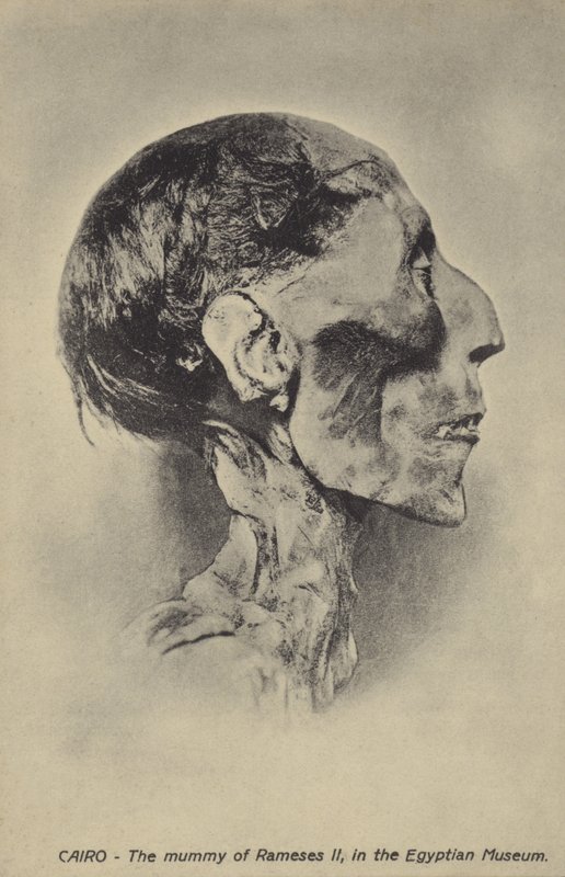 Mummy of Ramesses II by French Photographer