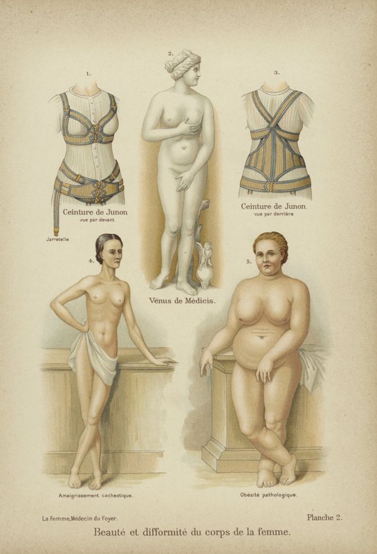 Beauty and Misshapenness in the Female Body by German School