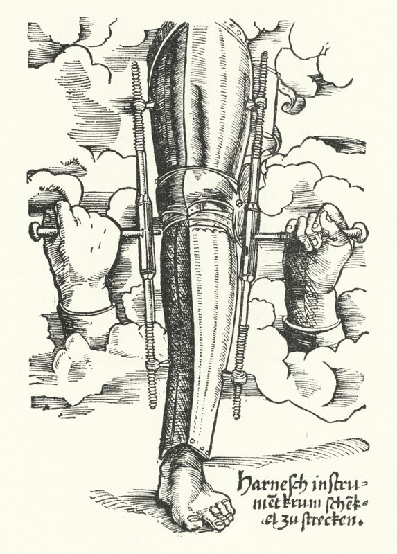Device to Straighten a Wounded Leg by German School