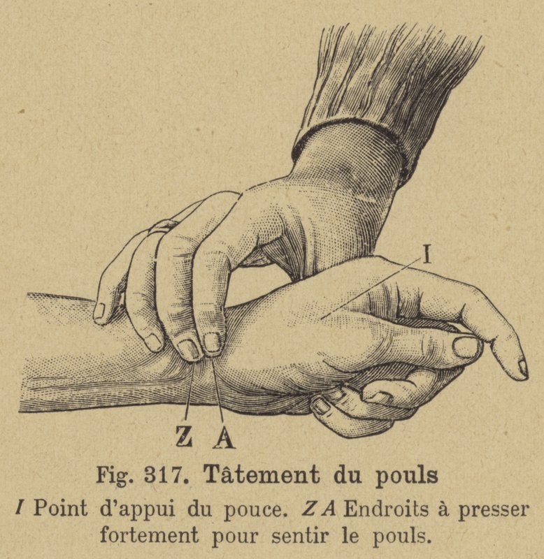 Taking the Pulse at the Wrist by German School